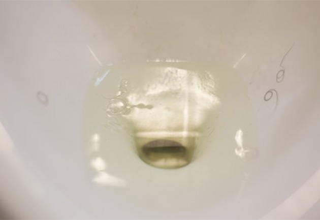 luka_pesun_dlaka_630